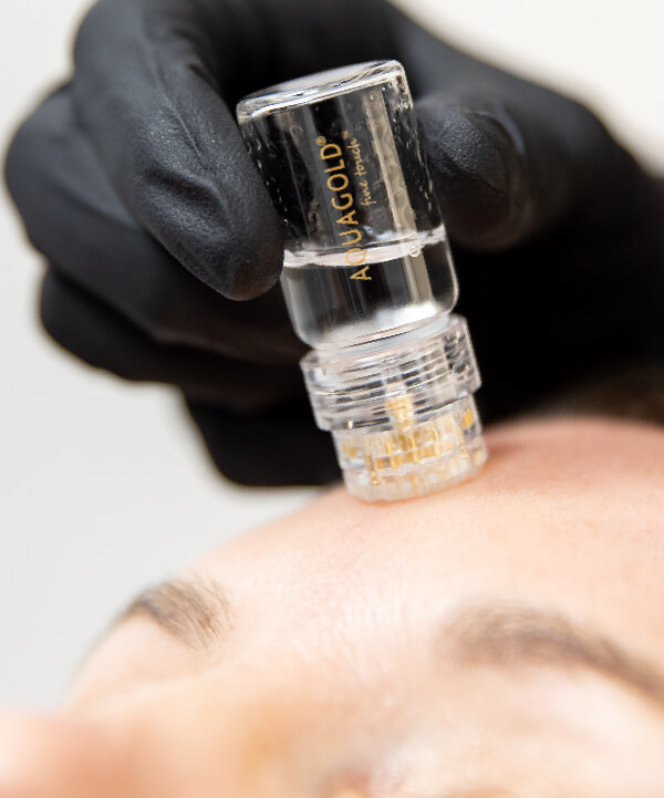 AQUAGOLD MICRONEEDLING in Fremont, CA