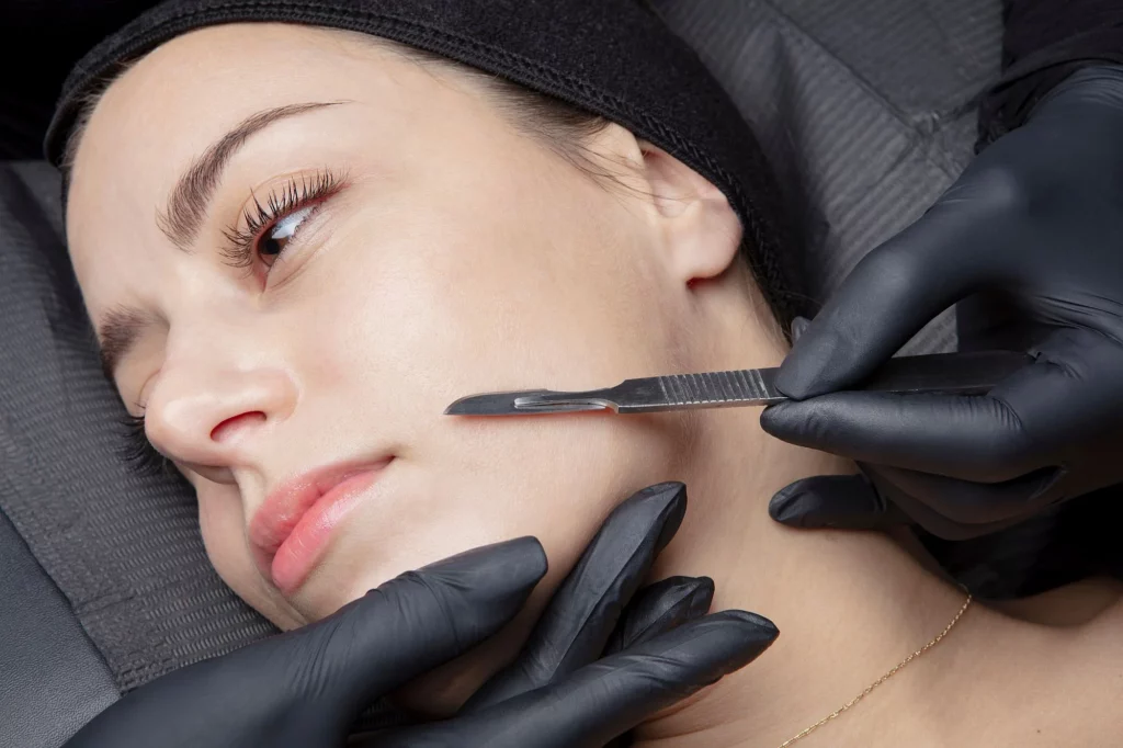 Dermaplaning Facial In Fremont, CA