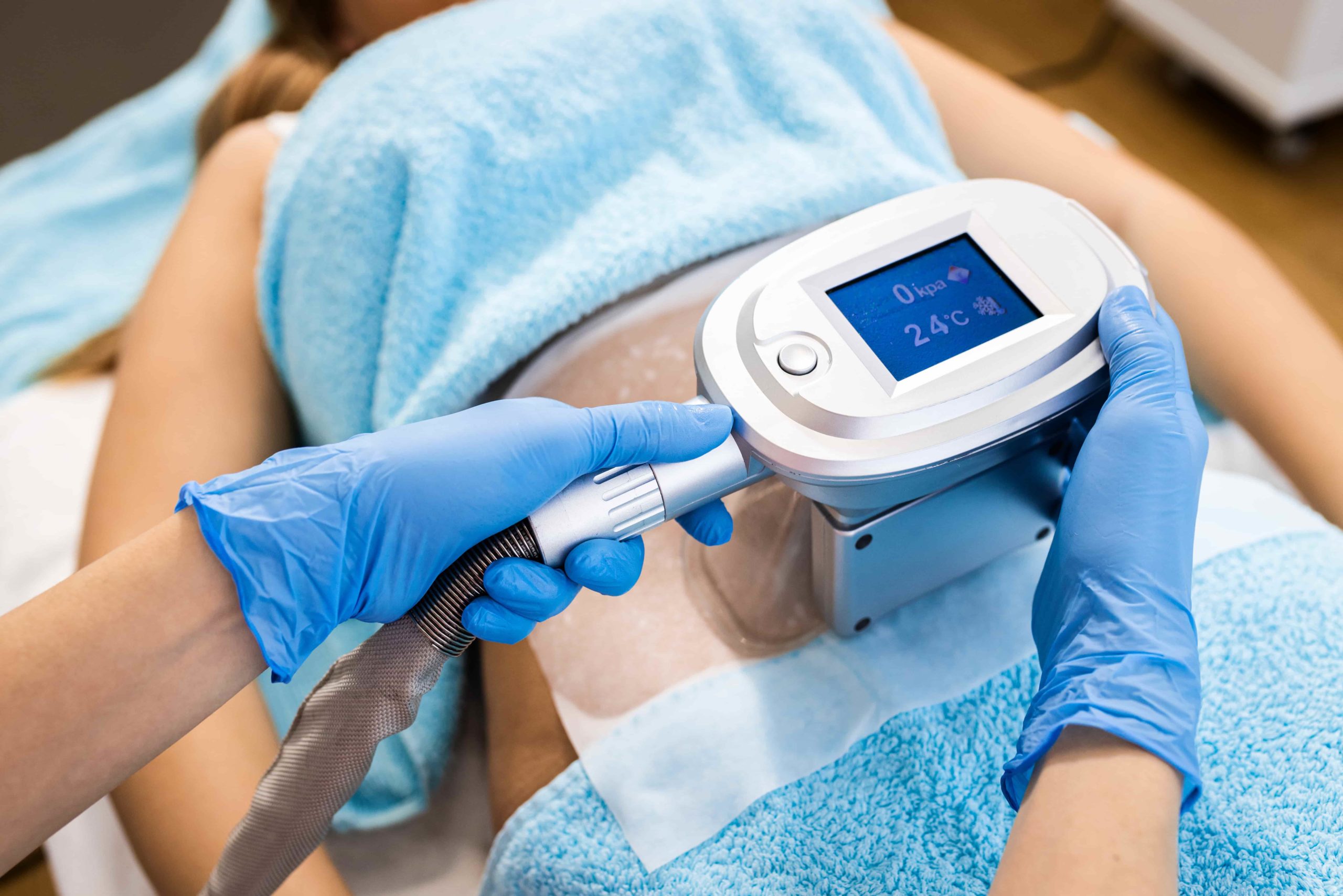 The benefits of CoolSculpting over other non-surgical fat reduction treatments