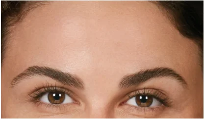 after-botox in Fremont, CA Ariba Medical Spa