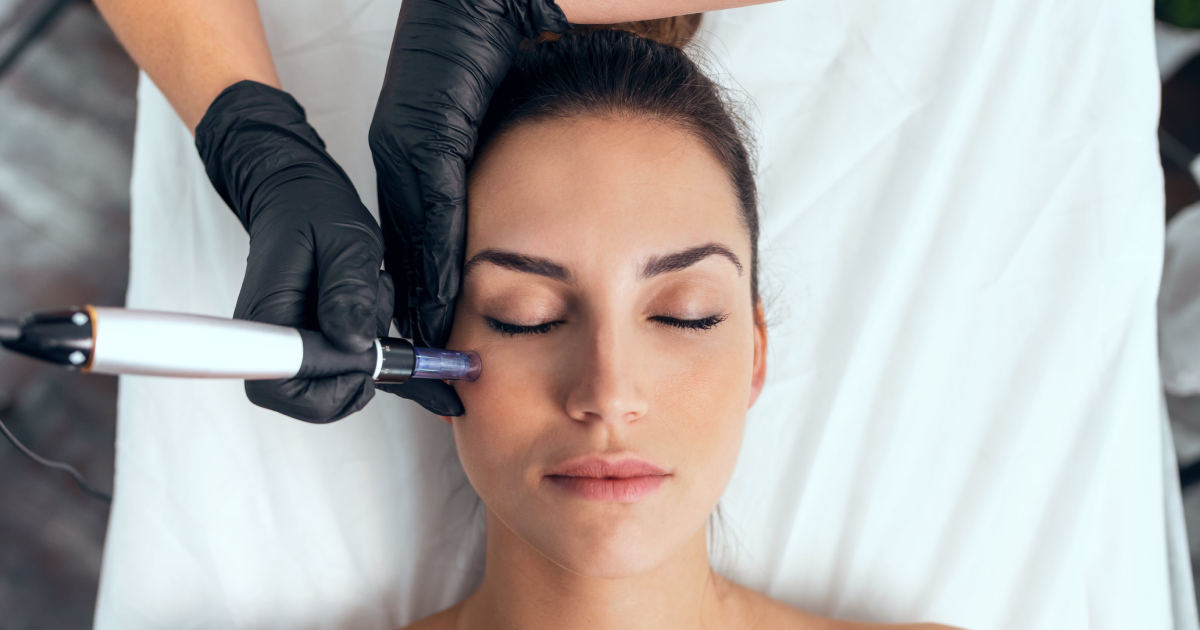 Aquagold Microneedling treatment on woman's face at clinic in Fremont, CA