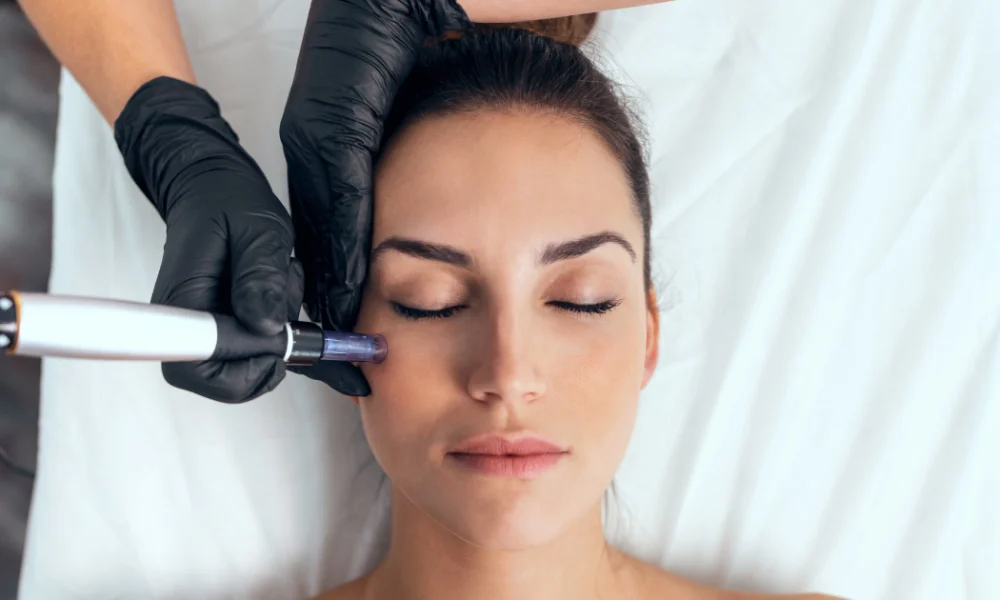 Aquagold Microneedling treatment on woman's face at clinic in Fremont, CA