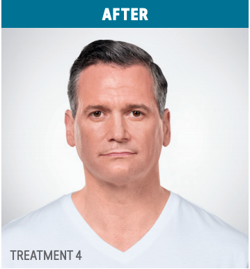 after1in Fremont, CA Ariba Medical Spa after1in Fremont, CA Ariba Medical Spa