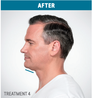 after2 in Fremont, CA Ariba Medical Spa after2 in Fremont, CA Ariba Medical Spa