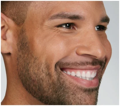 before-botox in Fremont, CA Ariba Medical Spa before-botox in Fremont, CA Ariba Medical Spa