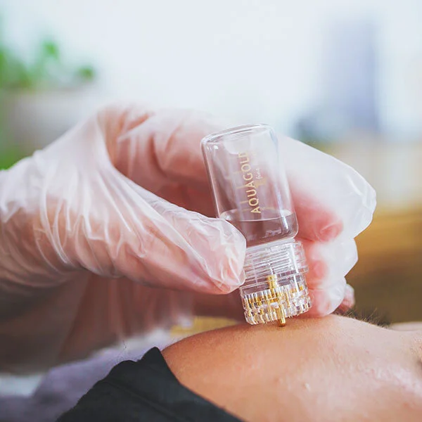 Aquagold-Fine-Touch-Application in Fremont, CA Ariba Medical Spa
